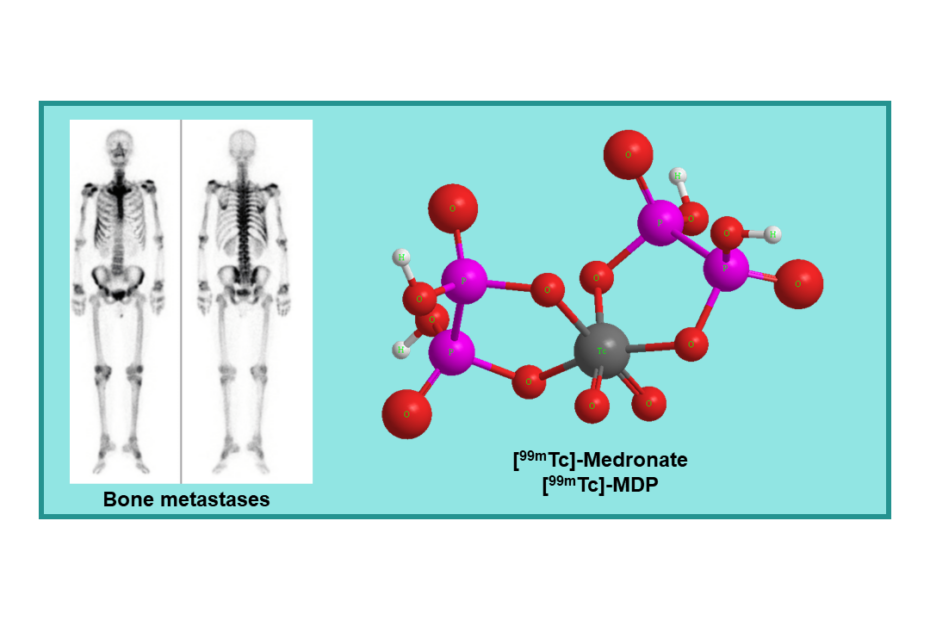 [99mTc]-Medronate (MDP)