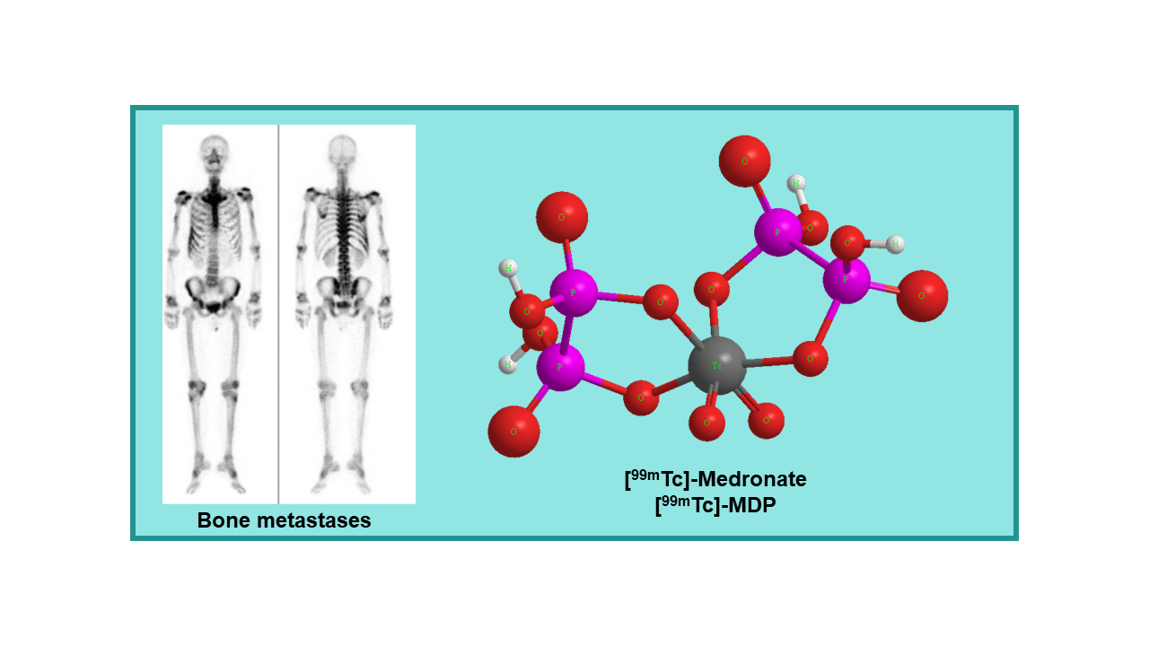 [99mTc]-Medronate (MDP)