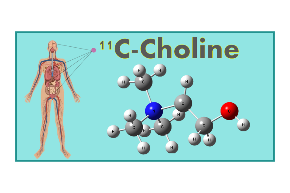 11C-Choline (11C-CH)