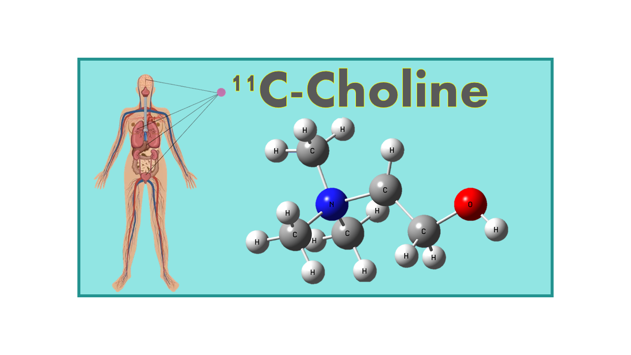 11C-Choline (11C-CH)