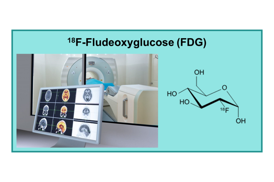 18F-Fludeoxyglucose (FDG)