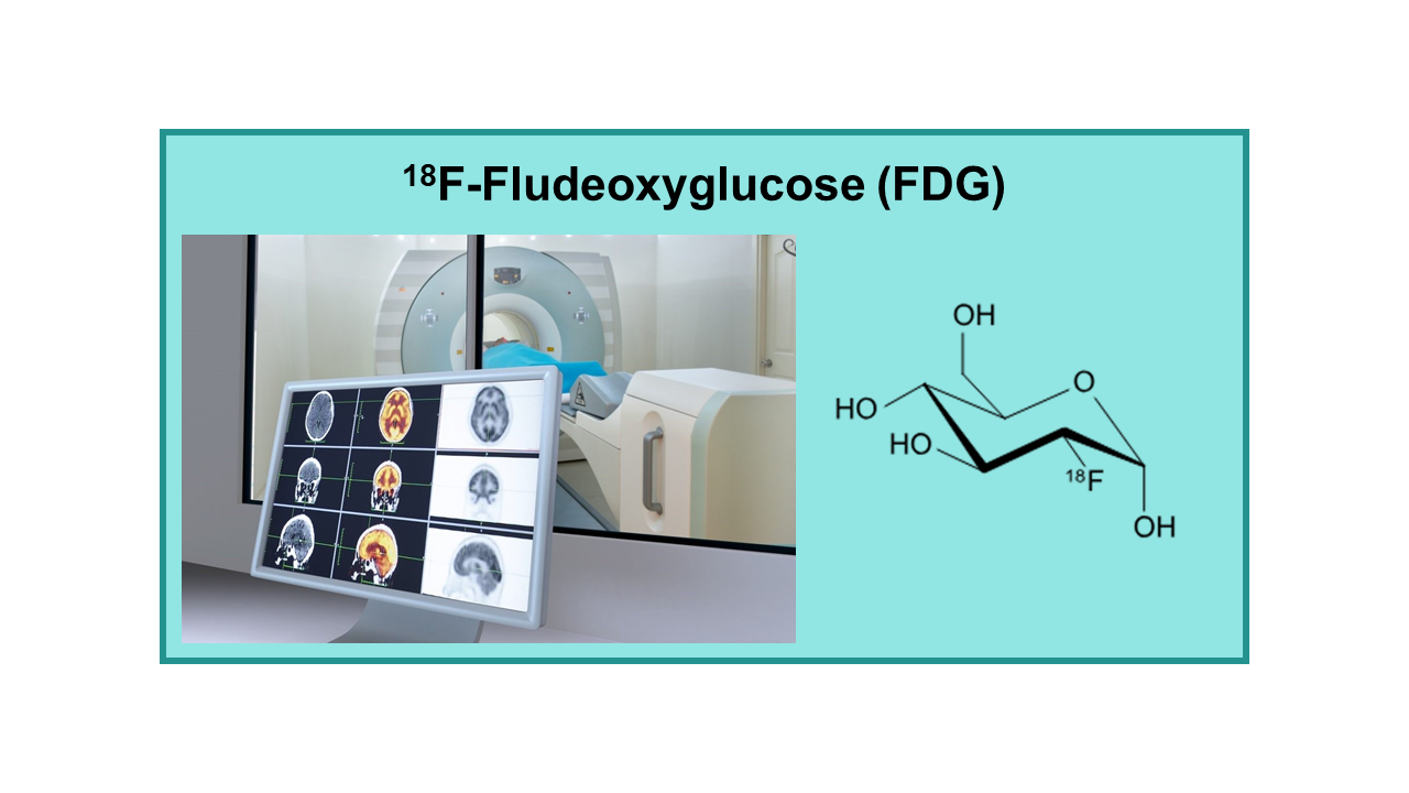 18F-Fludeoxyglucose (FDG)