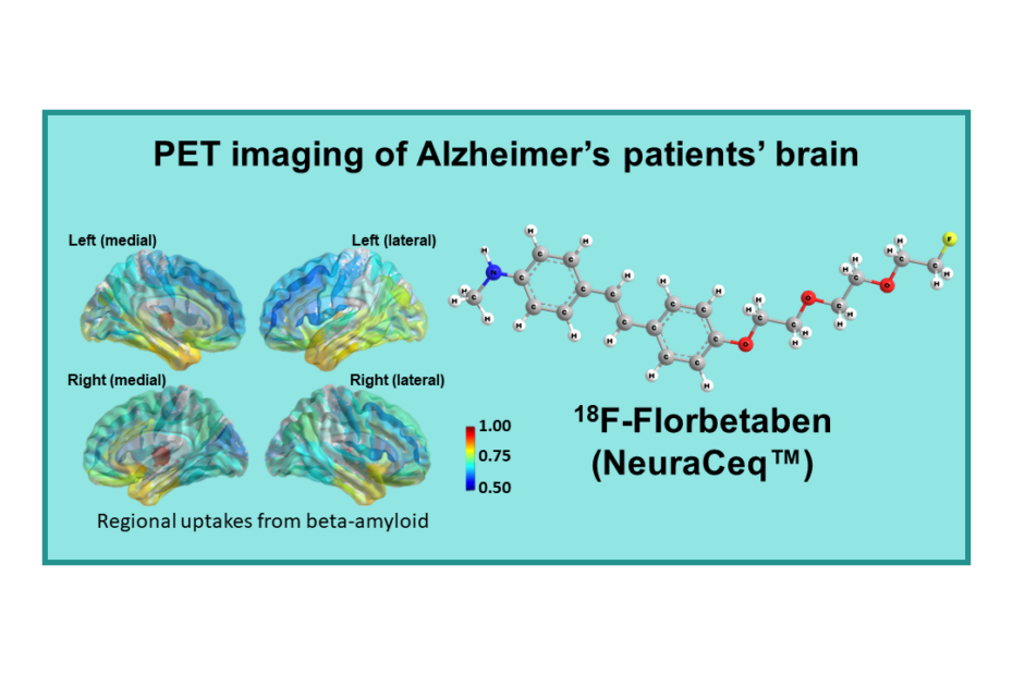 18F-Florbetaben (NeuraCeq™)