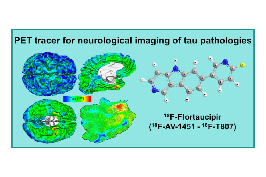 18F-Flortaucipir