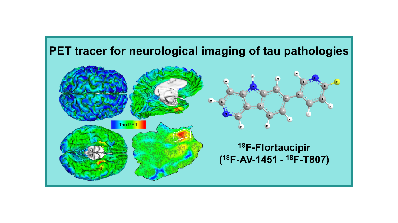 18F-Flortaucipir