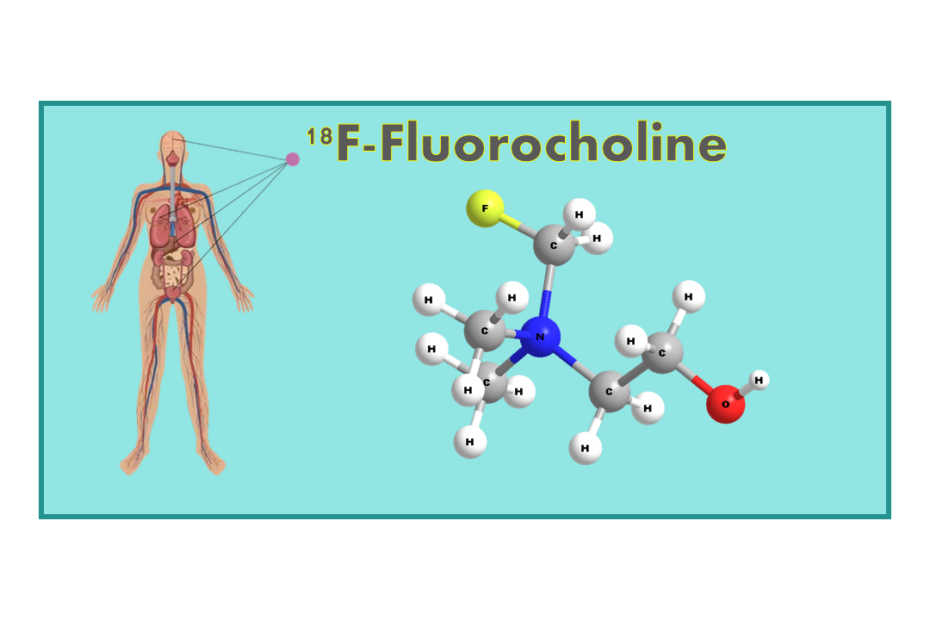 18F-Fluorocholine