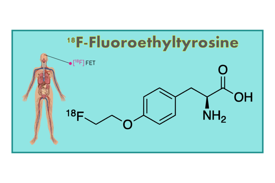 18F-Fluoroethyltyrosine (FET)