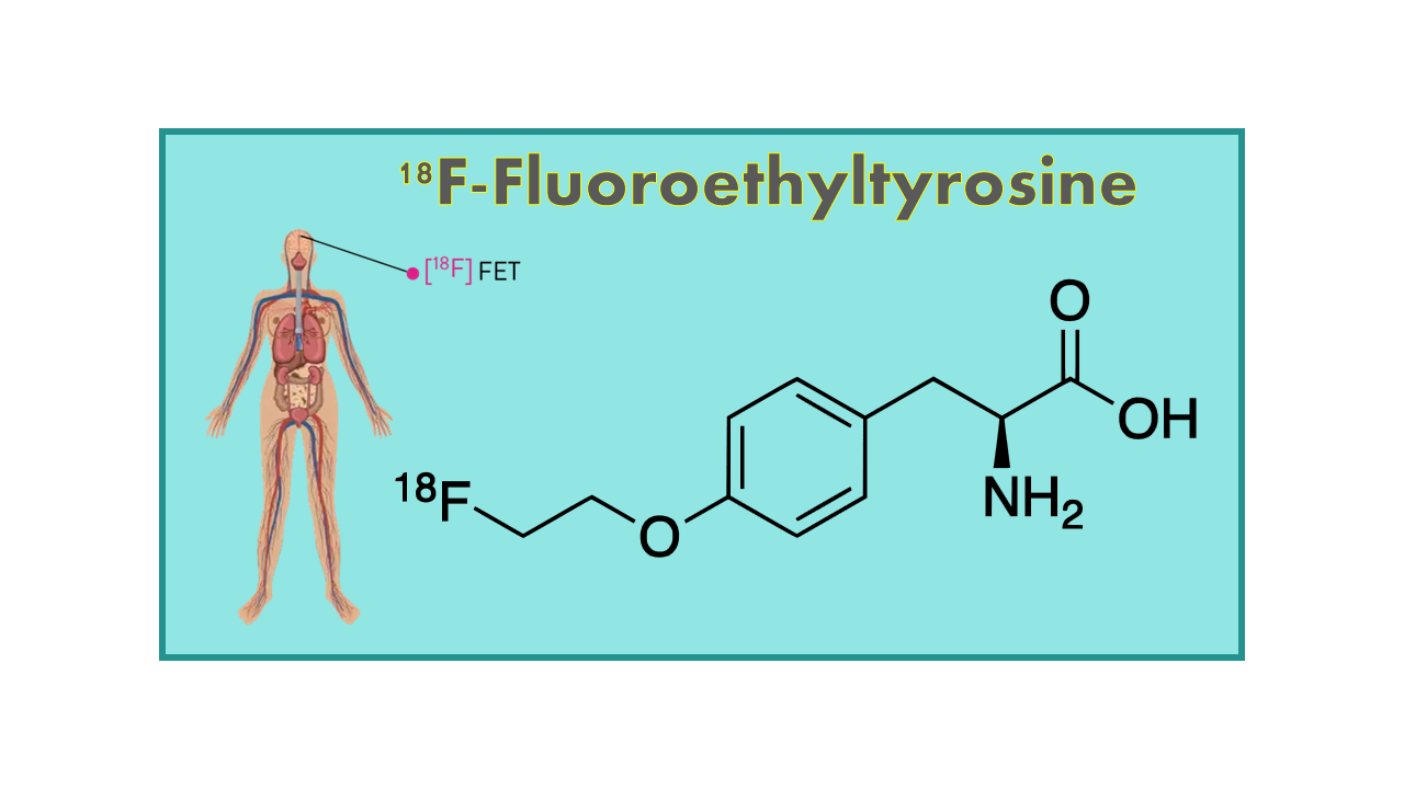 18F-Fluoroethyltyrosine (FET)