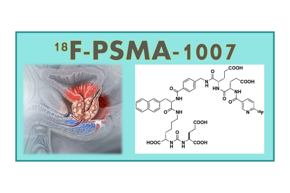 18F-PSMA-1007