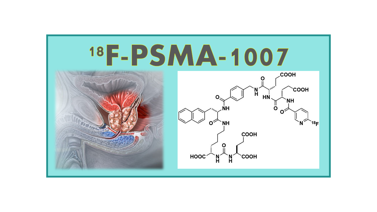 18F-PSMA-1007