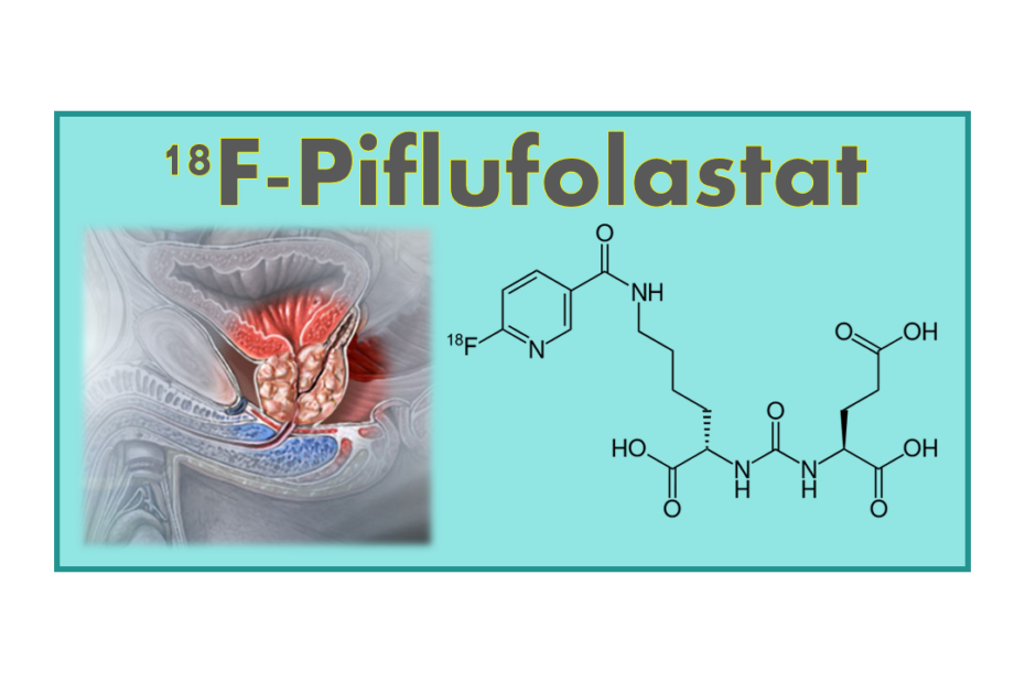 18F-Piflufolastat (18F-DCFPyL)