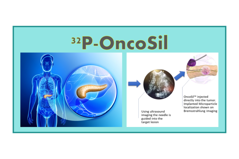 32P-OncoSil