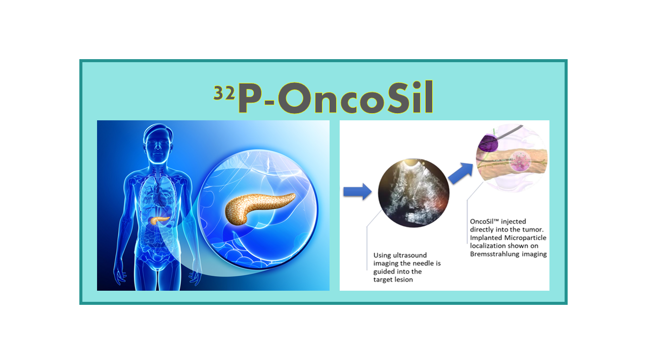 32P-OncoSil