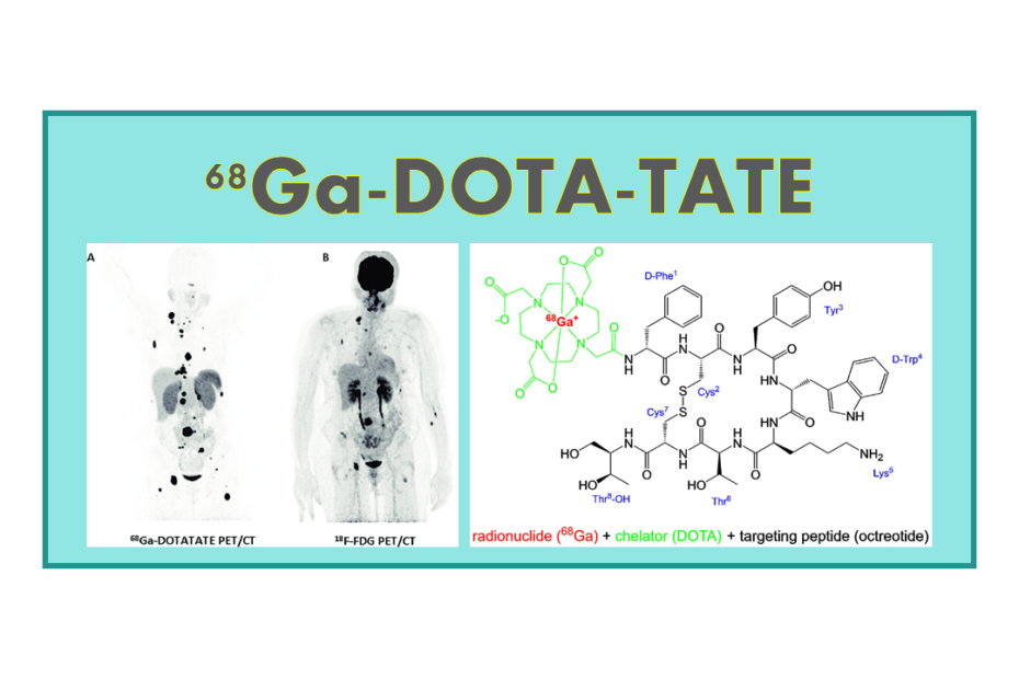 68Ga-DOTATATE (Octreotate)