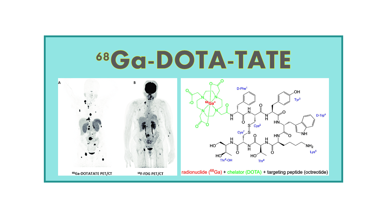 68Ga-DOTATATE (Octreotate)