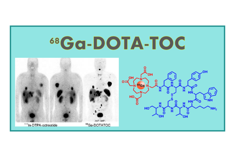 68Ga-DOTATOC (Octreotide)