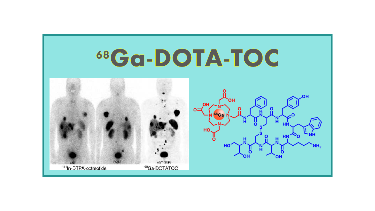 68Ga-DOTATOC (Octreotide)