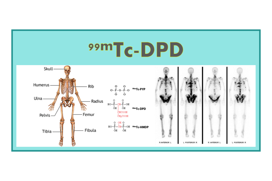 99mTc-DPD