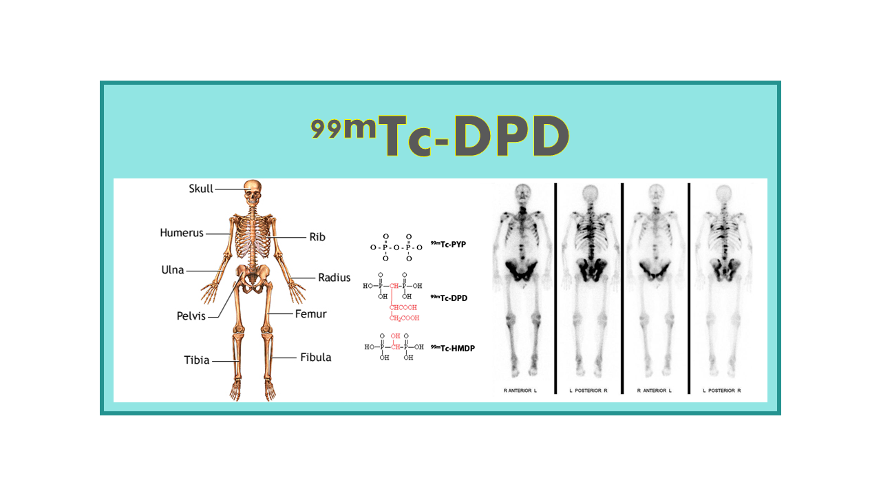 99mTc-DPD