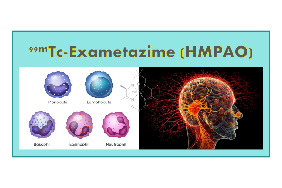 99mTc-Exametazime (HMPAO)