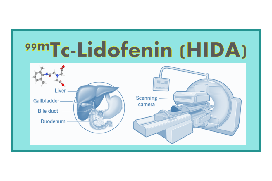 99mTc-Lidofenin (HIDA)