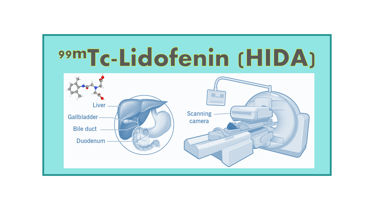 99mTc-Lidofenin (HIDA)