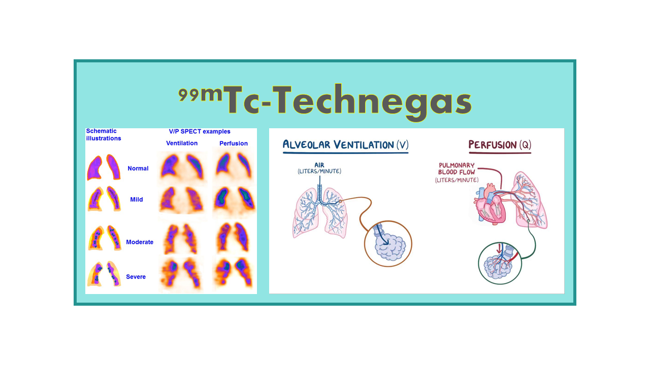 99mTc-Technegas