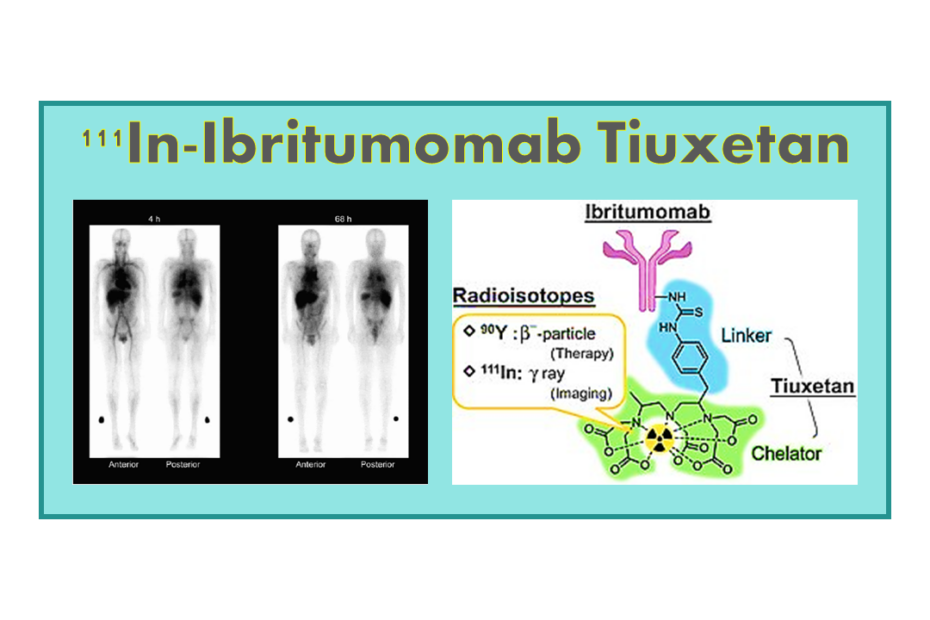 111In-Ibritumomab Tiuxetan