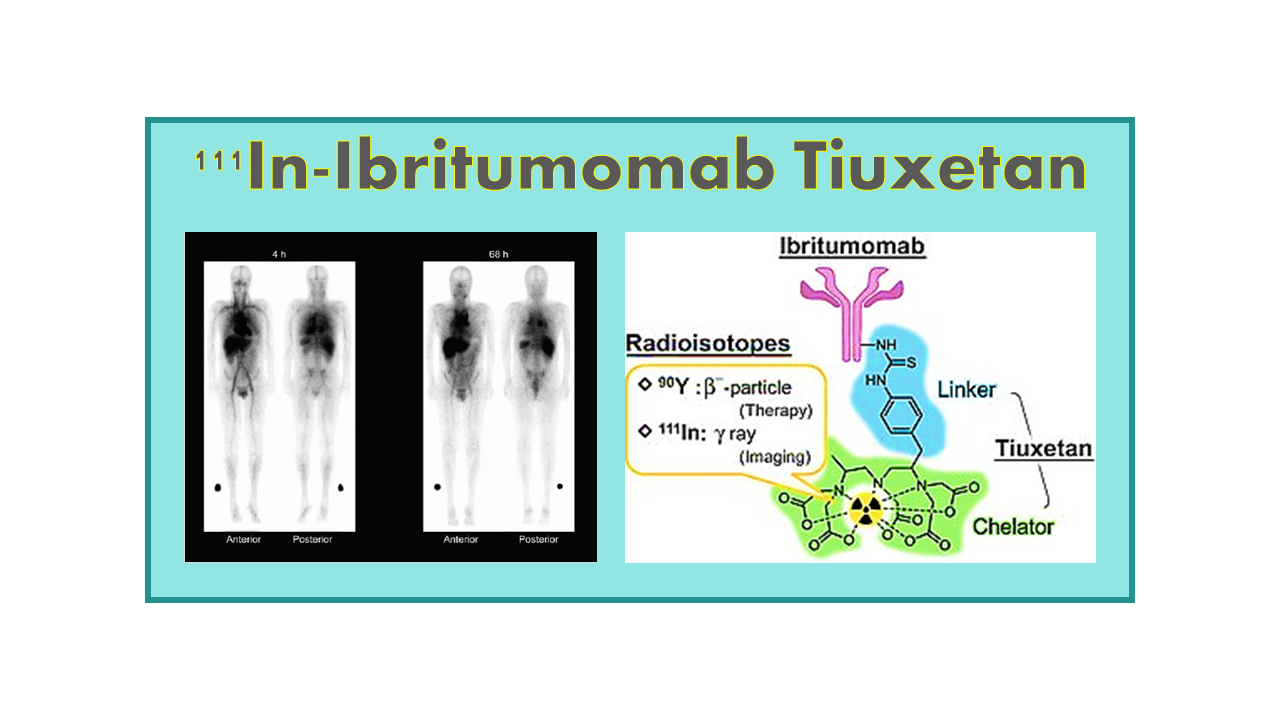 111In-Ibritumomab Tiuxetan